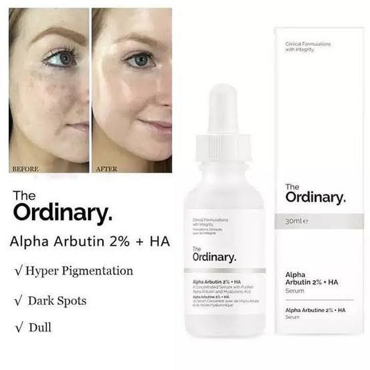 The Ordinary Alpha Arbutin 2% + HA